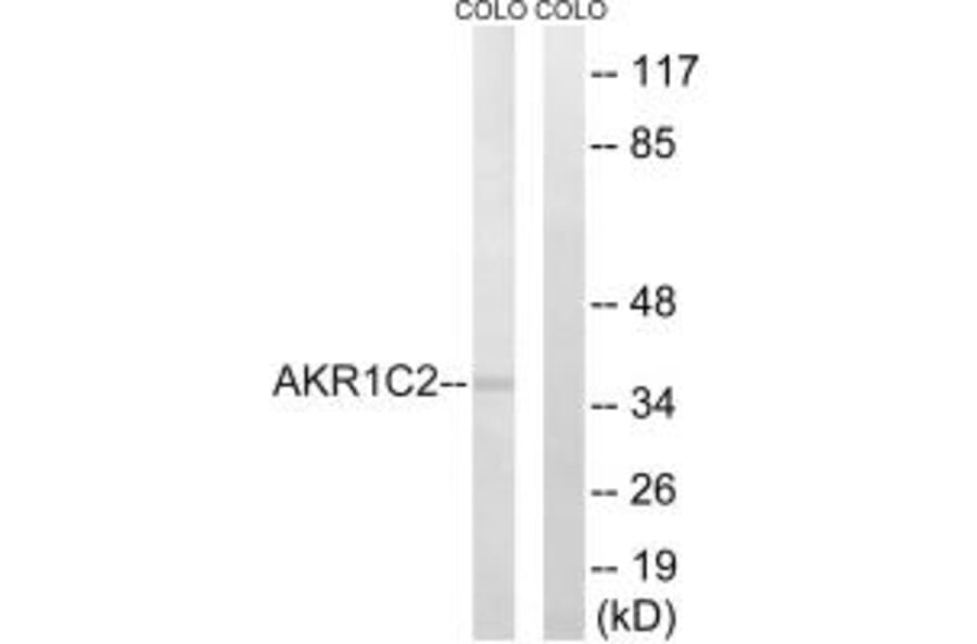 Western blot - AKR1C2 Antibody from Signalway Antibody (34400) - Antibodies.com