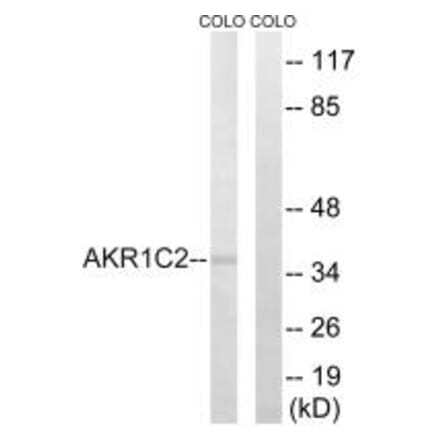 Western blot - AKR1C2 Antibody from Signalway Antibody (34400) - Antibodies.com