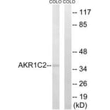 Western blot - AKR1C2 Antibody from Signalway Antibody (34400) - Antibodies.com