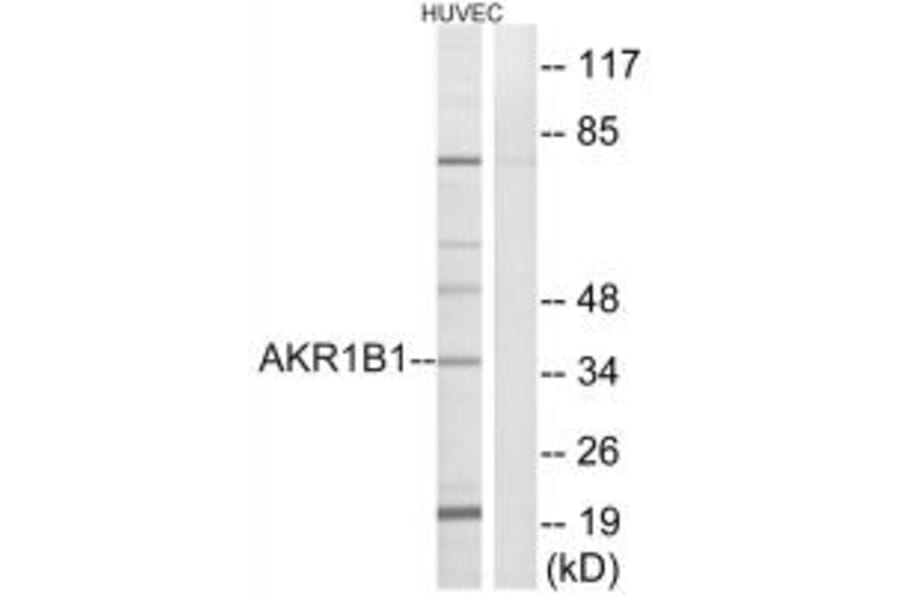 Western blot - AKR1B1 Antibody from Signalway Antibody (34403) - Antibodies.com
