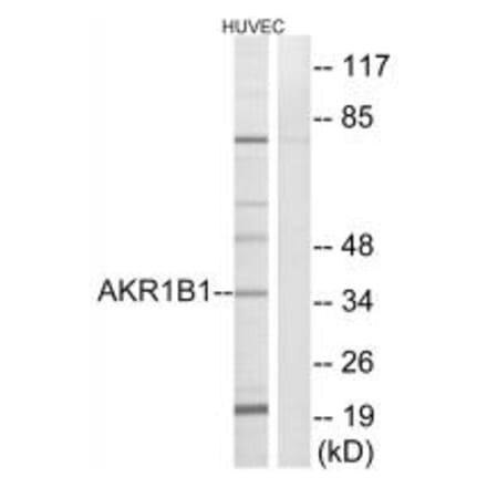 Western blot - AKR1B1 Antibody from Signalway Antibody (34403) - Antibodies.com