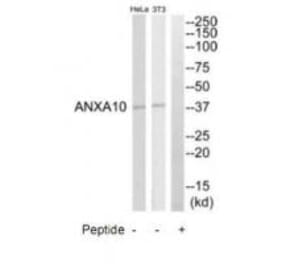 Western blot - ANXA10 Antibody from Signalway Antibody (34426) - Antibodies.com