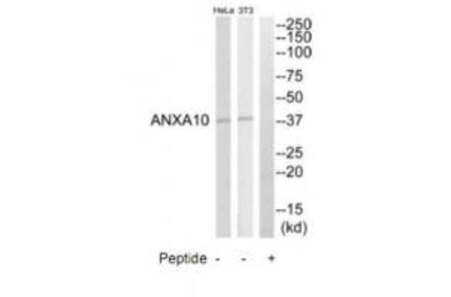Western blot - ANXA10 Antibody from Signalway Antibody (34426) - Antibodies.com