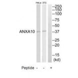 Western blot - ANXA10 Antibody from Signalway Antibody (34426) - Antibodies.com