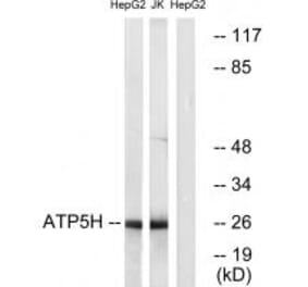 Western blot - ATP5H Antibody from Signalway Antibody (34446) - Antibodies.com