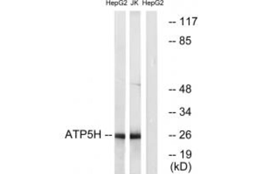Western blot - ATP5H Antibody from Signalway Antibody (34446) - Antibodies.com
