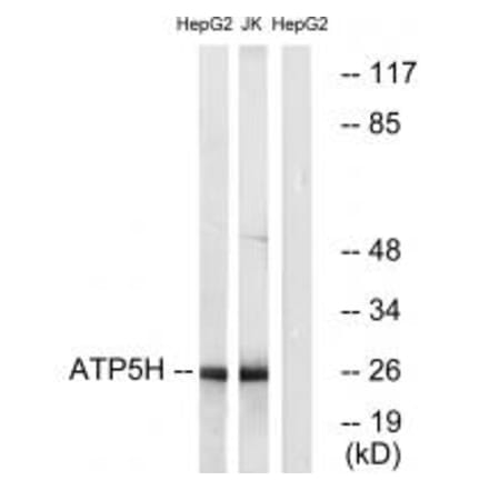 Western blot - ATP5H Antibody from Signalway Antibody (34446) - Antibodies.com
