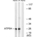 Western blot - ATP5H Antibody from Signalway Antibody (34446) - Antibodies.com