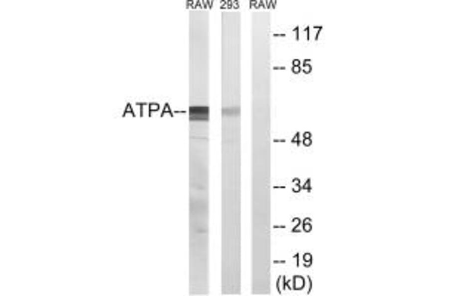 Western blot - ATP5A1 Antibody from Signalway Antibody (34453) - Antibodies.com