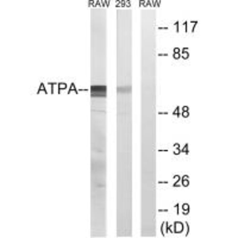 Western blot - ATP5A1 Antibody from Signalway Antibody (34453) - Antibodies.com