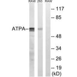 Western blot - ATP5A1 Antibody from Signalway Antibody (34453) - Antibodies.com