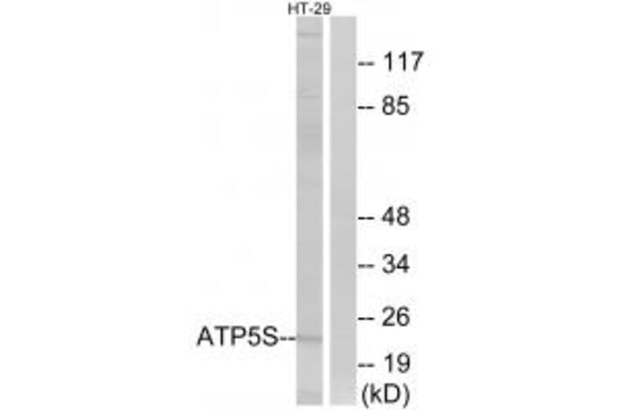 Western blot - ATP5S Antibody from Signalway Antibody (34455) - Antibodies.com