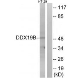 Western blot - DDX19B Antibody from Signalway Antibody (34465) - Antibodies.com