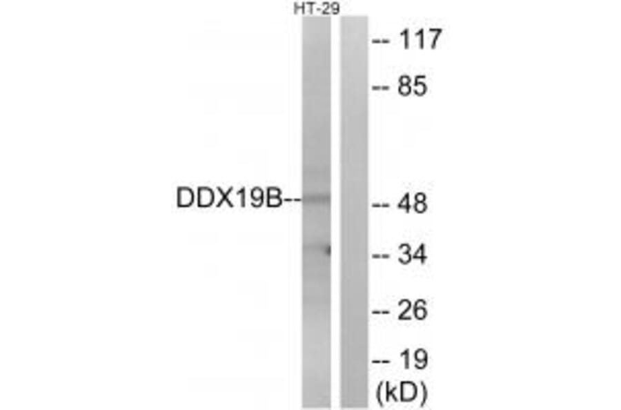 Western blot - DDX19B Antibody from Signalway Antibody (34465) - Antibodies.com