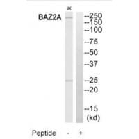 Western blot analysis of extracts from Jurkat cells, using BAZ2A antibody #34511.