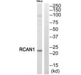 Western blot - RCAN1 Antibody from Signalway Antibody (34513) - Antibodies.com