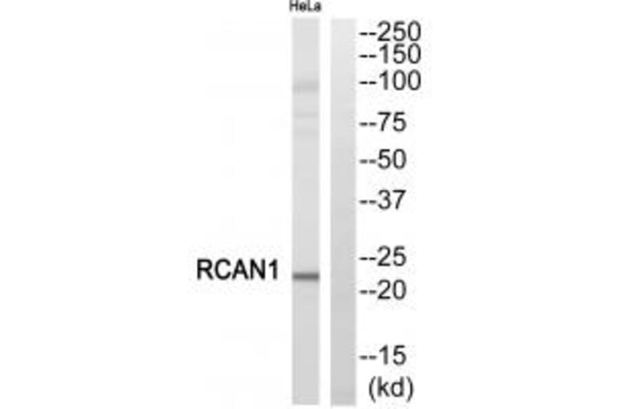 Western blot - RCAN1 Antibody from Signalway Antibody (34513) - Antibodies.com