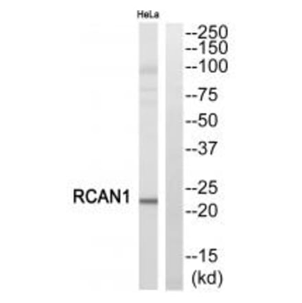 Western blot - RCAN1 Antibody from Signalway Antibody (34513) - Antibodies.com