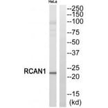 Western blot - RCAN1 Antibody from Signalway Antibody (34513) - Antibodies.com