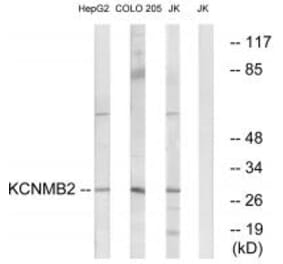 Western blot - KCNMB2 Antibody from Signalway Antibody (34514) - Antibodies.com