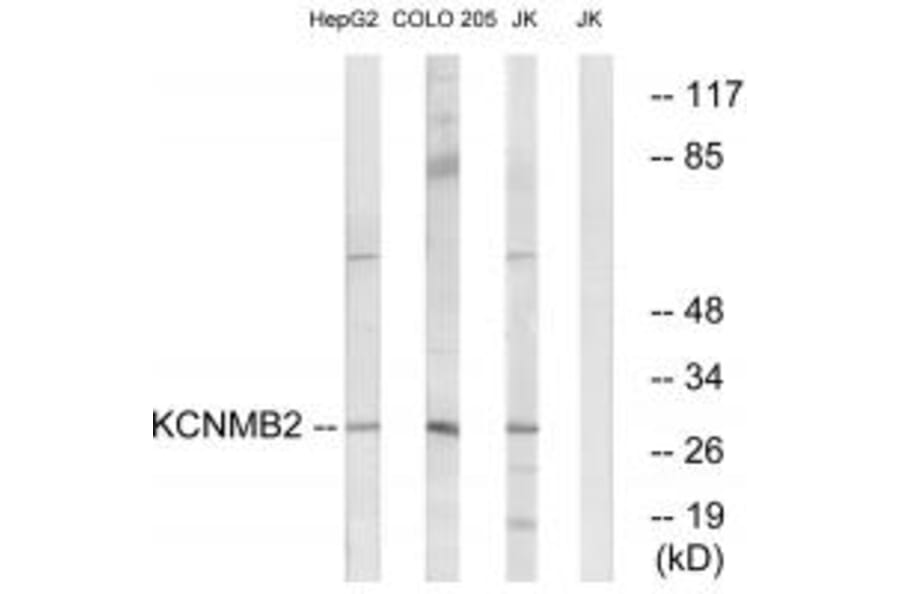 Western blot - KCNMB2 Antibody from Signalway Antibody (34514) - Antibodies.com