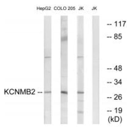 Western blot - KCNMB2 Antibody from Signalway Antibody (34514) - Antibodies.com