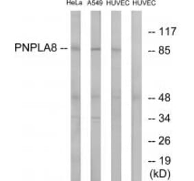 Western blot - PNPLA8 Antibody from Signalway Antibody (34518) - Antibodies.com