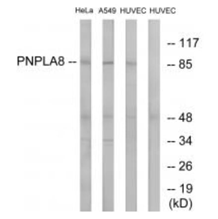 Western blot - PNPLA8 Antibody from Signalway Antibody (34518) - Antibodies.com