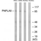 Western blot - PNPLA8 Antibody from Signalway Antibody (34518) - Antibodies.com