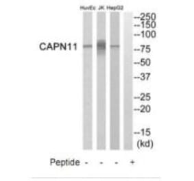 Western blot - CAPN11 Antibody from Signalway Antibody (34519) - Antibodies.com