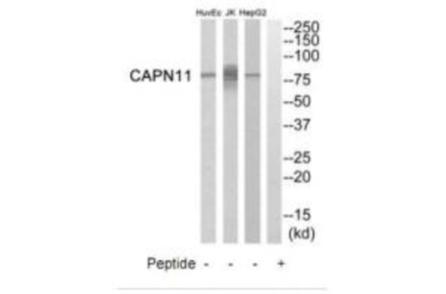 Western blot - CAPN11 Antibody from Signalway Antibody (34519) - Antibodies.com