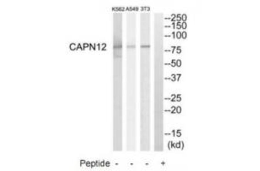 Western blot - CAPN12 Antibody from Signalway Antibody (34520) - Antibodies.com