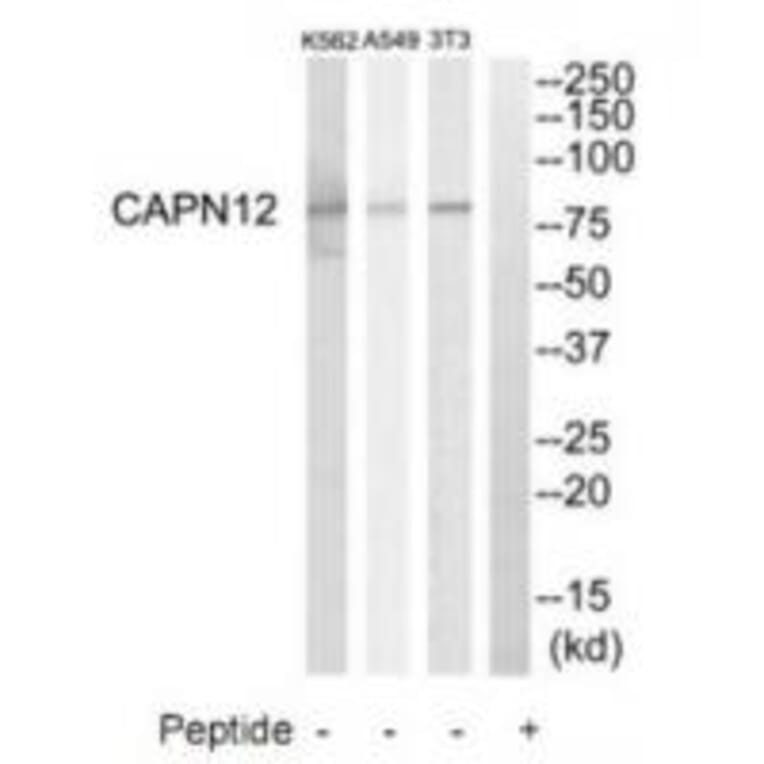 Western blot - CAPN12 Antibody from Signalway Antibody (34520) - Antibodies.com