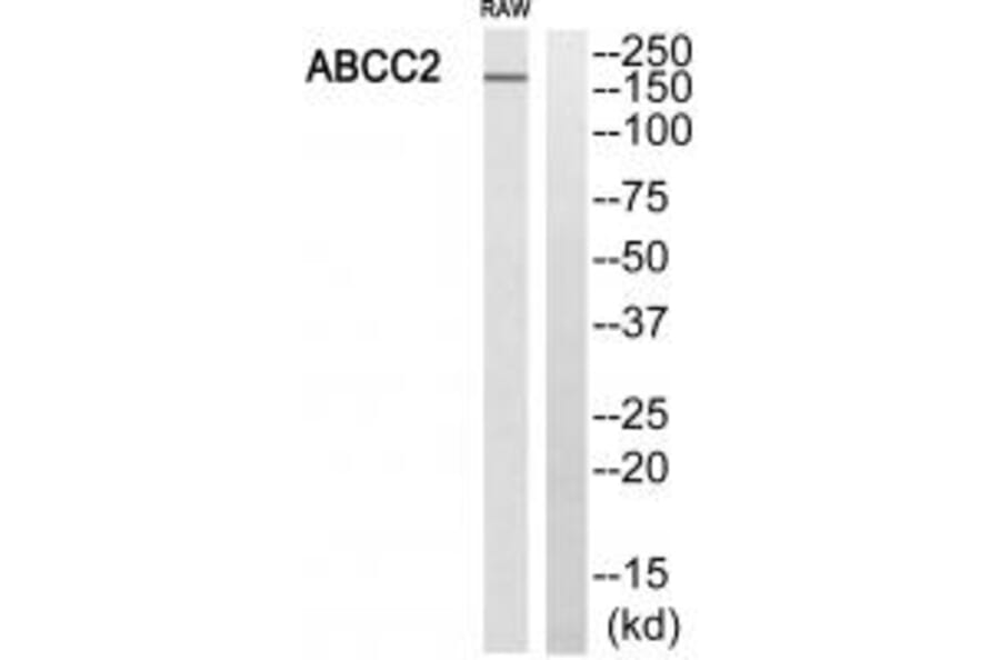 Western blot - ABCC2 Antibody from Signalway Antibody (34526) - Antibodies.com