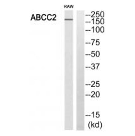 Western blot - ABCC2 Antibody from Signalway Antibody (34526) - Antibodies.com