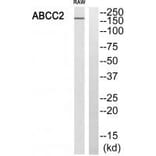 Western blot - ABCC2 Antibody from Signalway Antibody (34526) - Antibodies.com