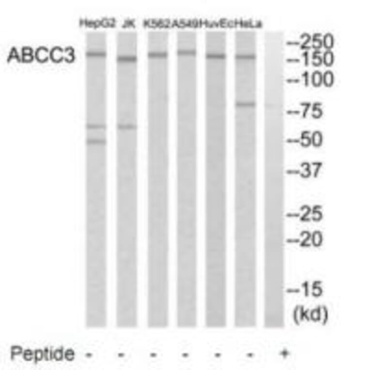 Western blot - ABCC3 Antibody from Signalway Antibody (34527) - Antibodies.com