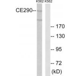 Western blot - CEP290 Antibody from Signalway Antibody (34563) - Antibodies.com