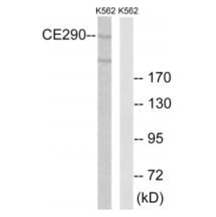 Western blot - CEP290 Antibody from Signalway Antibody (34563) - Antibodies.com