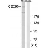 Western blot - CEP290 Antibody from Signalway Antibody (34563) - Antibodies.com