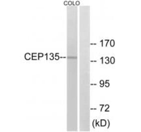 Western blot - CEP135 Antibody from Signalway Antibody (34564) - Antibodies.com