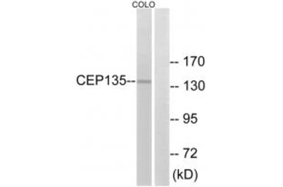 Western blot - CEP135 Antibody from Signalway Antibody (34564) - Antibodies.com