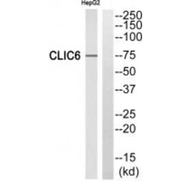 Western blot - CLIC6 Antibody from Signalway Antibody (34582) - Antibodies.com