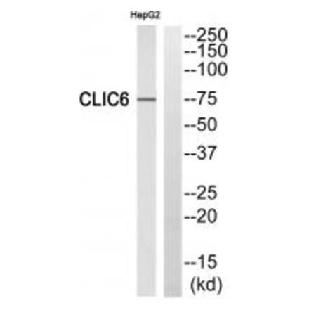 Western blot - CLIC6 Antibody from Signalway Antibody (34582) - Antibodies.com