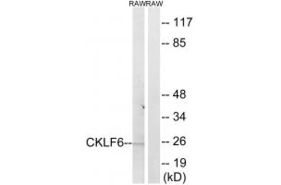 Western blot - CKLF6 Antibody from Signalway Antibody (34595) - Antibodies.com