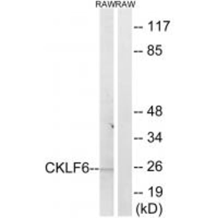 Western blot - CKLF6 Antibody from Signalway Antibody (34595) - Antibodies.com