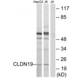 Western blot - CLDN19 Antibody from Signalway Antibody (34596) - Antibodies.com