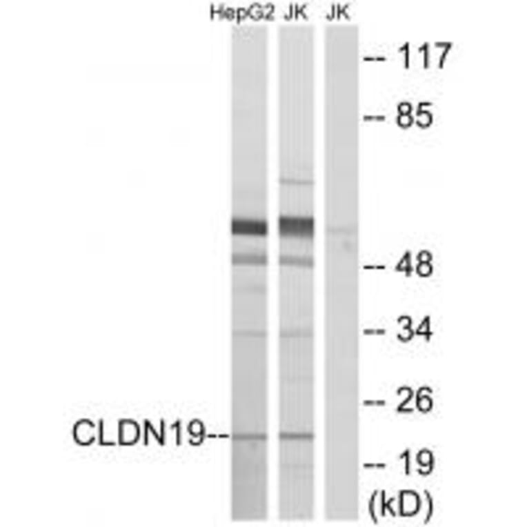 Western blot - CLDN19 Antibody from Signalway Antibody (34596) - Antibodies.com