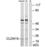 Western blot - CLDN19 Antibody from Signalway Antibody (34596) - Antibodies.com