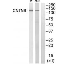 Western blot - CNTN6 Antibody from Signalway Antibody (34620) - Antibodies.com